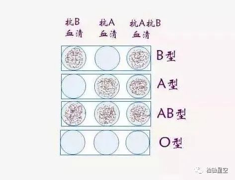 abo溶血什么情况下会发生